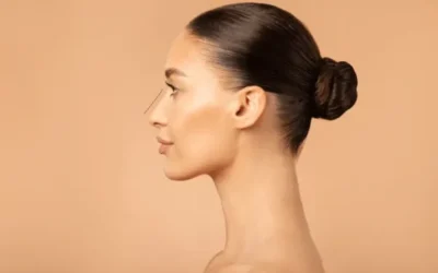 Innovación en Estética: Radiesse en Valencia y su impacto en el rejuvenecimiento facial